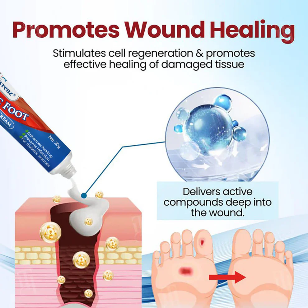 Cvreoz® Diabetic Foot Ulcer Repair Cream 4 Cvreoz® Diabetic Foot Ulcer Repair Cream