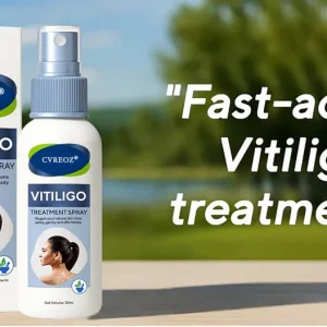 Cvreoz® Vitiligo Treatment Spray 15 Cvreoz® Vitiligo Treatment Spray