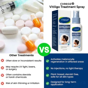 Cvreoz® Vitiligo Treatment Spray 13 Cvreoz® Vitiligo Treatment Spray
