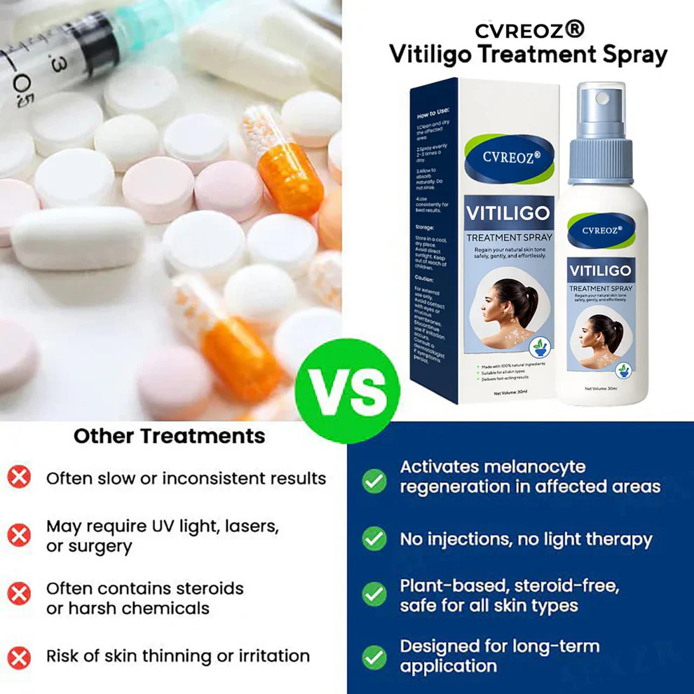 Cvreoz® Vitiligo Treatment Spray 5 Cvreoz® Vitiligo Treatment Spray