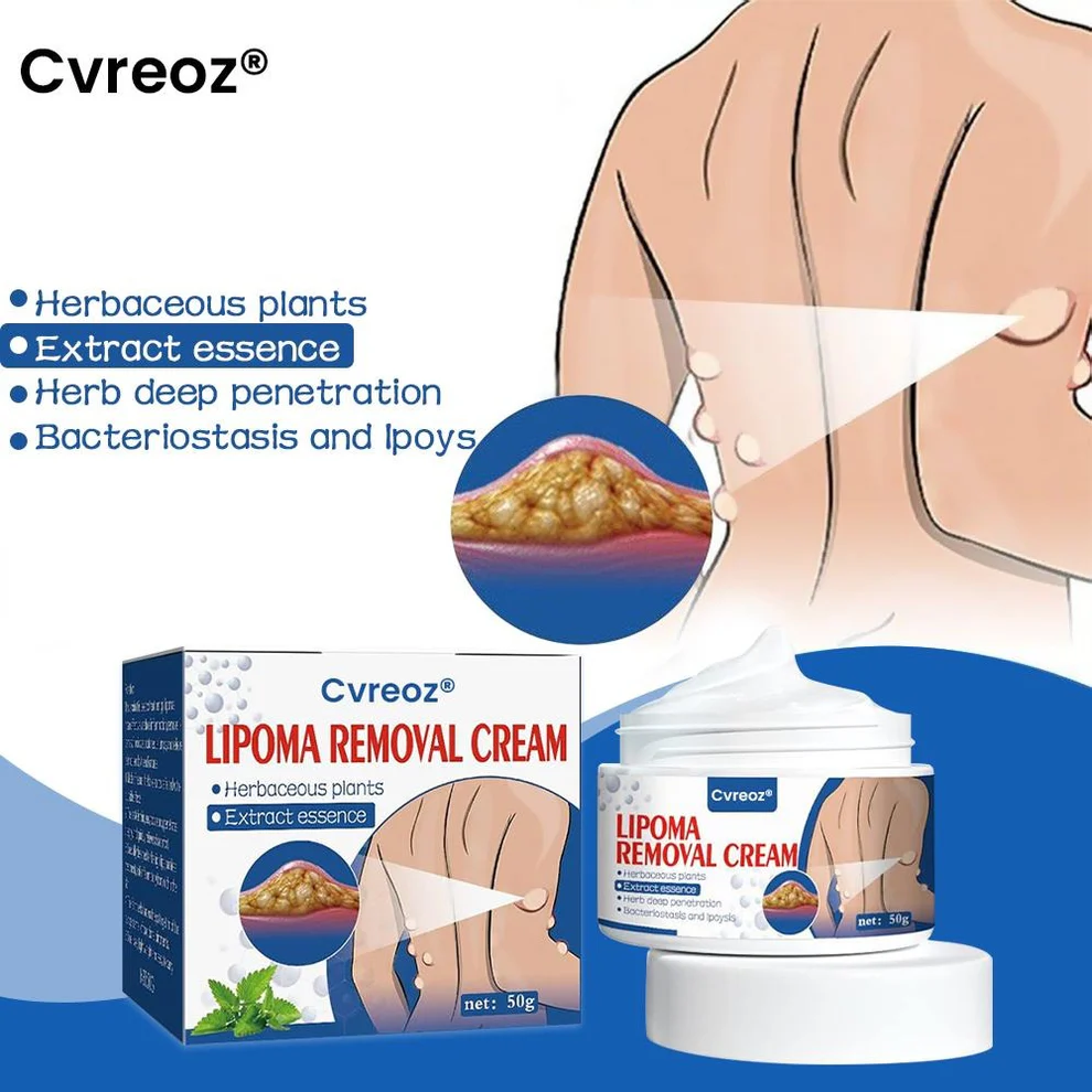 Cvreoz® Lipoma Removal Cream 1 Cvreoz® Lipoma Removal Cream