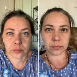 Japan Vision Drops — Rapidly Heals All Eye Conditions & Restores Vision 8 Japan Vision Drops — Rapidly Heals All Eye Conditions & Restores Vision