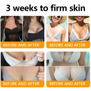 ADFIRE® Bee venom Comprehensive Cream 17 ADFIRE® Bee venom Comprehensive Cream