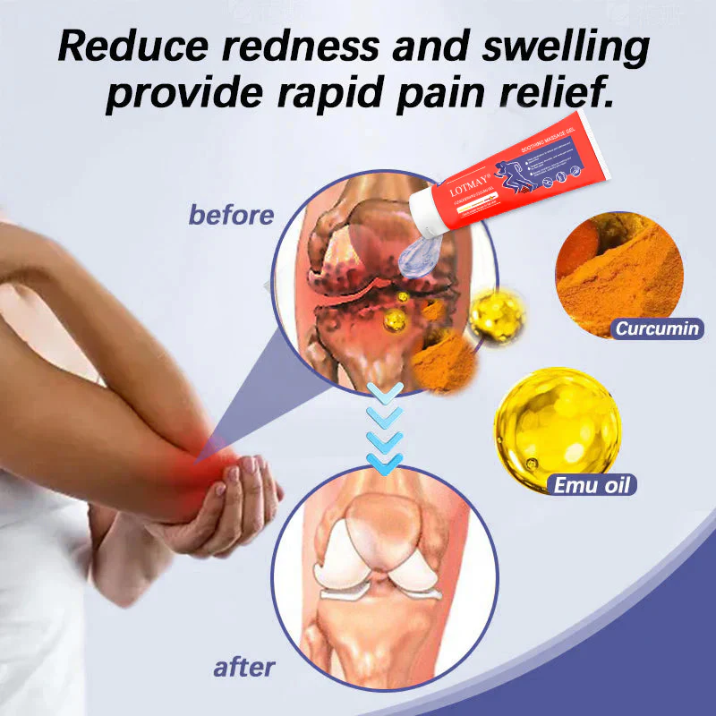 LOTMAY® Turmeric & Emu Oil Arthritis Soothing Pain Relief Massage Gel 7 LOTMAY® Turmeric & Emu Oil Arthritis Soothing Pain Relief Massage Gel