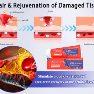 LOTMAY® Turmeric & Emu Oil Arthritis Soothing Pain Relief Massage Gel 17 LOTMAY® Turmeric & Emu Oil Arthritis Soothing Pain Relief Massage Gel