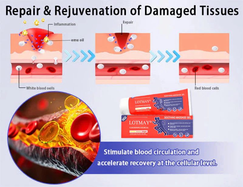LOTMAY® Turmeric & Emu Oil Arthritis Soothing Pain Relief Massage Gel 6 LOTMAY® Turmeric & Emu Oil Arthritis Soothing Pain Relief Massage Gel