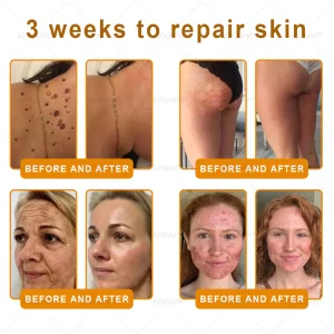 Daasry® Bee Venom Treatment Cream 15 Daasry® Bee Venom Treatment Cream