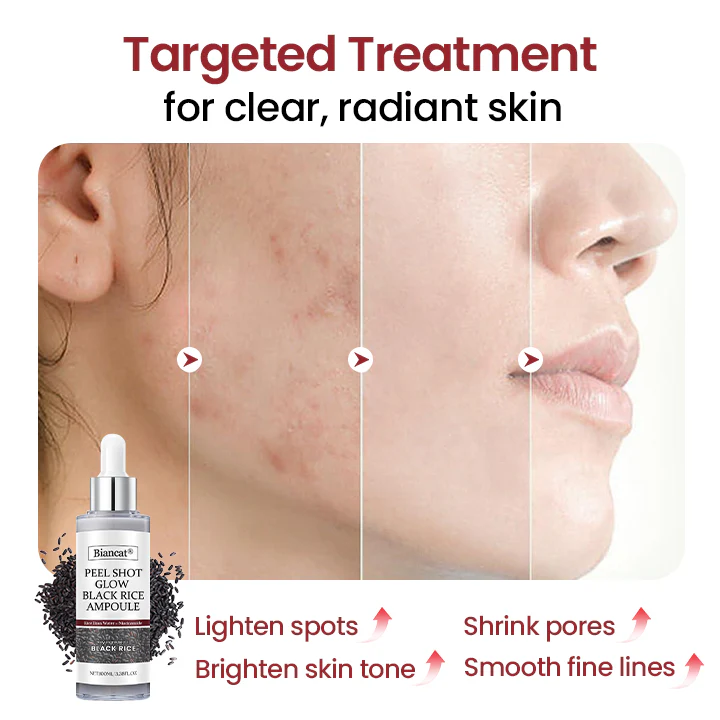 Biancat® Peel Shot Glow Black Rice Ampoule 5 Biancat® Peel Shot Glow Black Rice Ampoule
