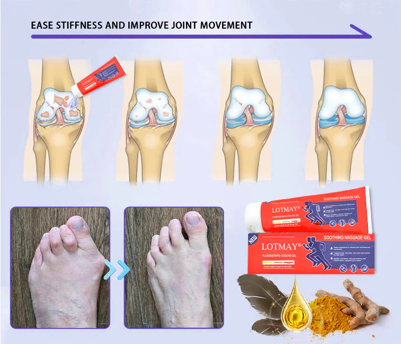 LOTMAY® Turmeric & Emu Oil Arthritis Soothing Pain Relief Massage Gel 3 LOTMAY® Turmeric & Emu Oil Arthritis Soothing Pain Relief Massage Gel