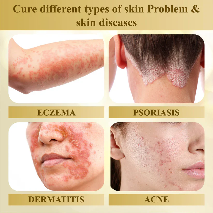 Cvreoz® Condense Mellifera Venom Skin Repairing Cream 4 Cvreoz® Condense Mellifera Venom Skin Repairing Cream