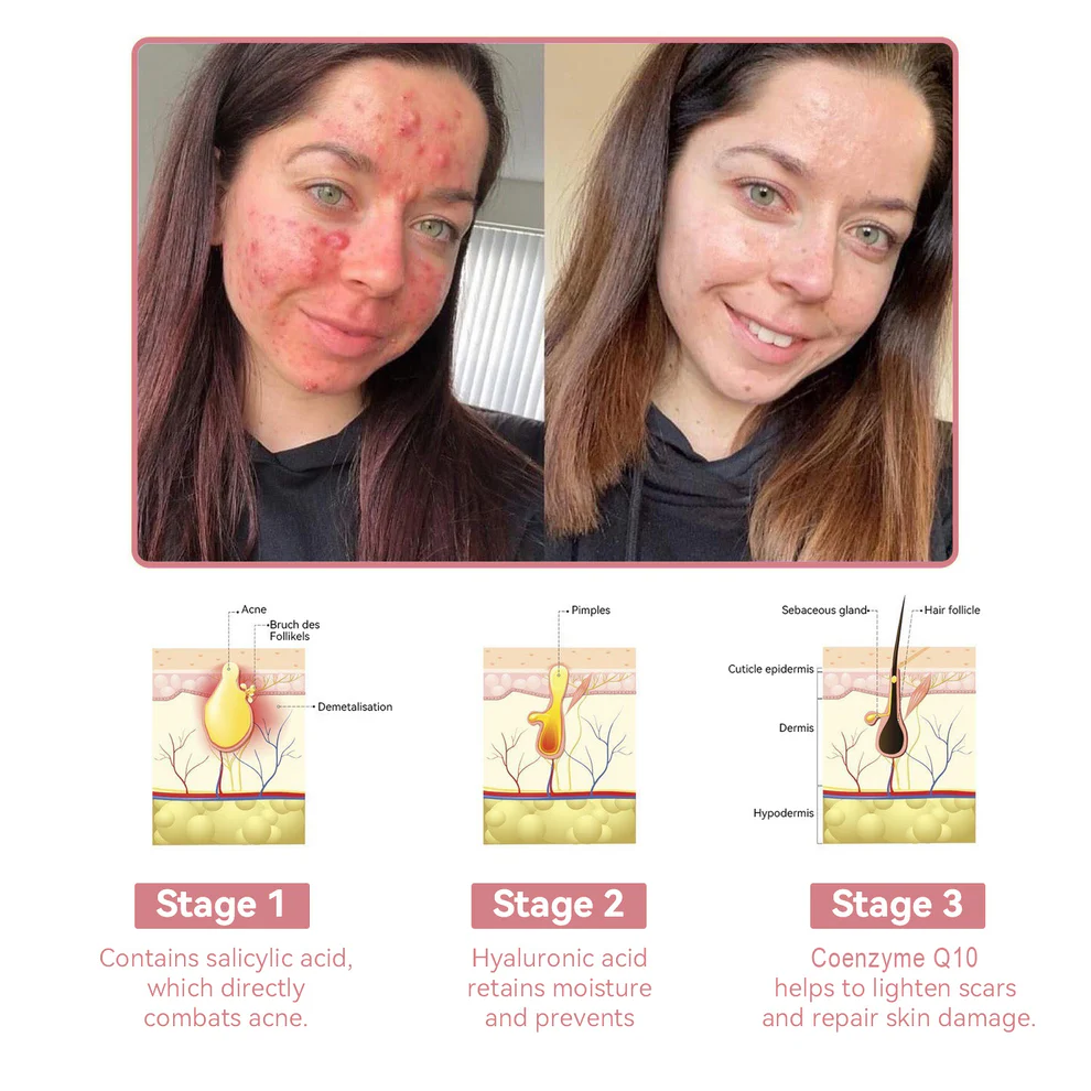 Awzlove™ Coenzyme Q10 Collagen Jelly Skin Cream 3 Awzlove™ Coenzyme Q10 Collagen Jelly Skin Cream