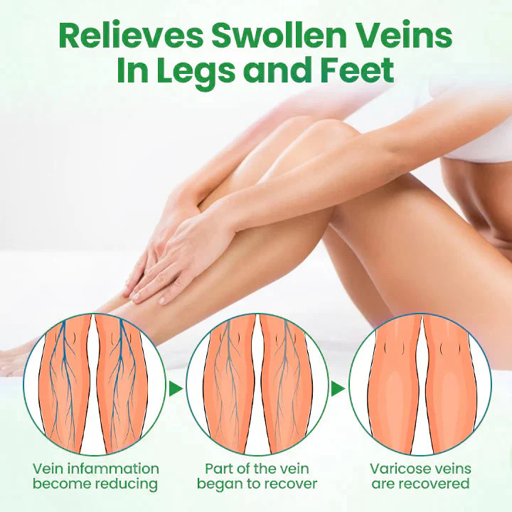 ADFIRE® VeinGuard Herbal Spray 3 ADFIRE® VeinGuard Herbal Spray