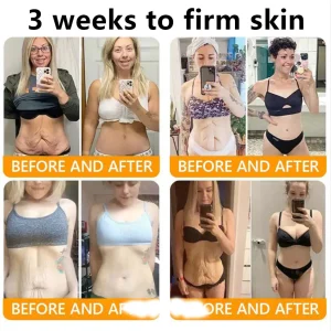 ADFIRE® Bee venom Comprehensive Cream 13 ADFIRE® Bee venom Comprehensive Cream