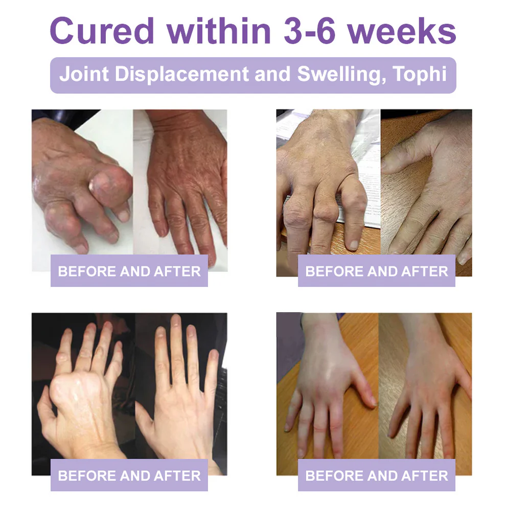 Zvoevo® Magnesium Pain Relief Cream 5 Zvoevo® Magnesium Pain Relief Cream