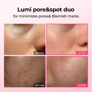 LUHAKA® Pore & Spot Care Duo 17 LUHAKA® Pore & Spot Care Duo