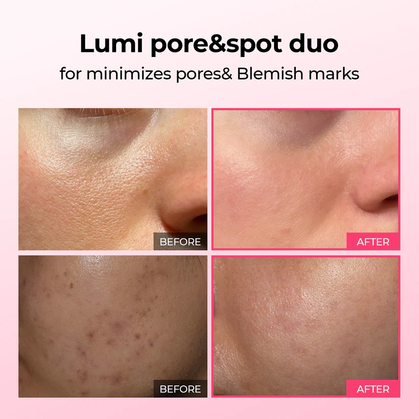 LUHAKA® Pore & Spot Care Duo 9 LUHAKA® Pore & Spot Care Duo