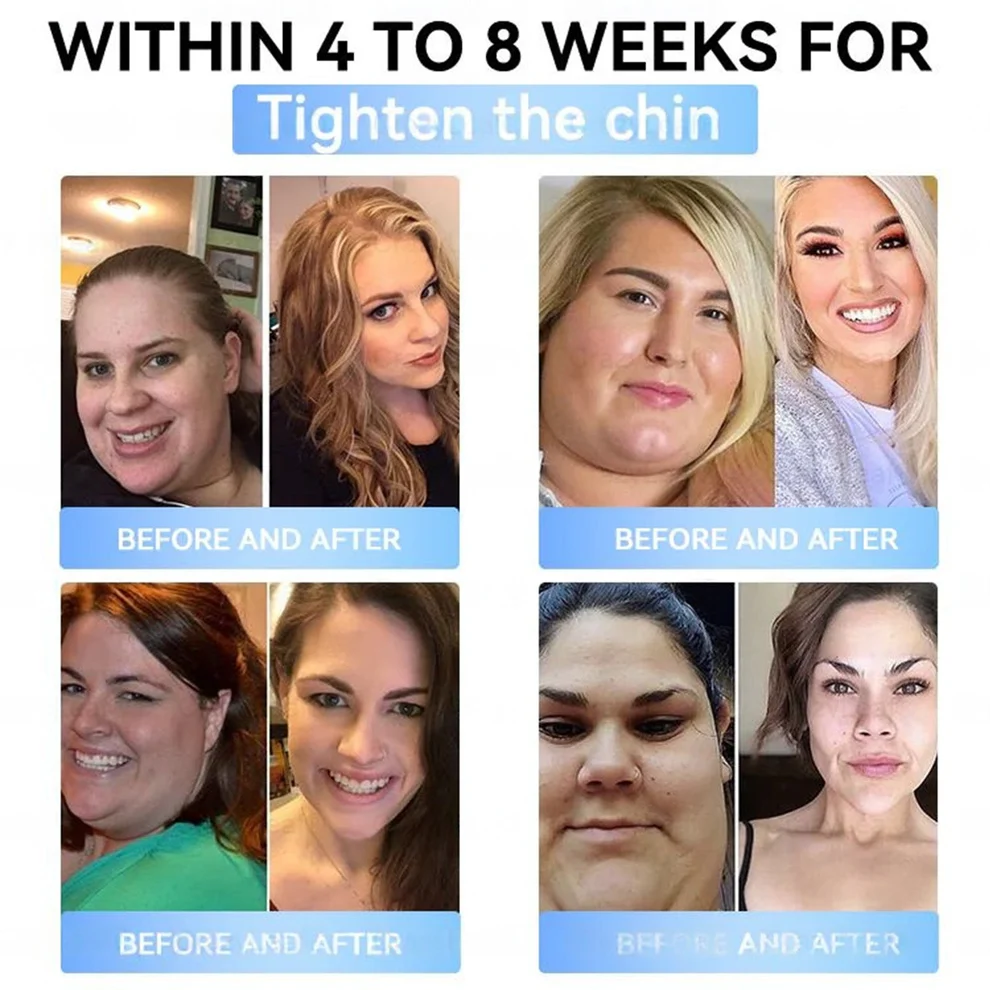 Croaie® GLP-1 Nano-Microneedle Patch with Collagen 3 Croaie® GLP-1 Nano-Microneedle Patch with Collagen