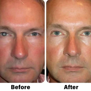 NESLEMY™ Nano Vision Repair Eye Serum 14 NESLEMY™ Nano Vision Repair Eye Serum