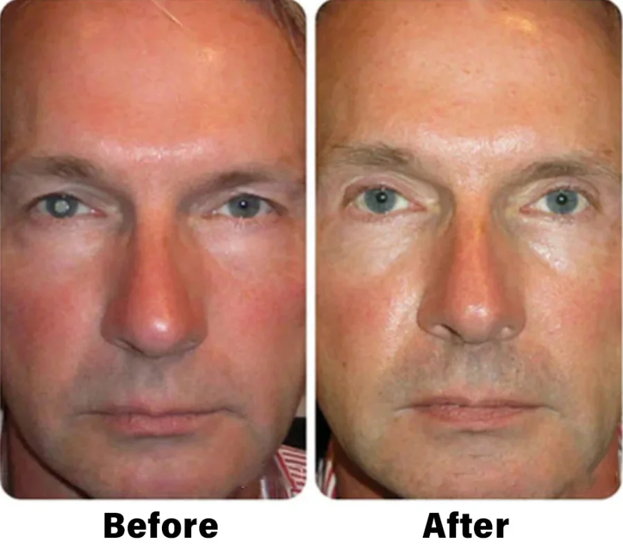 NESLEMY™ Nano Vision Repair Eye Serum 4 NESLEMY™ Nano Vision Repair Eye Serum