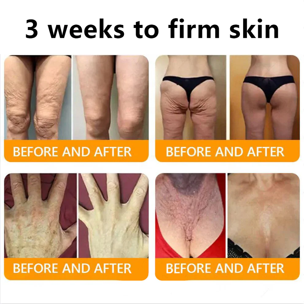 ADFIRE® Bee venom Comprehensive Cream 3 ADFIRE® Bee venom Comprehensive Cream