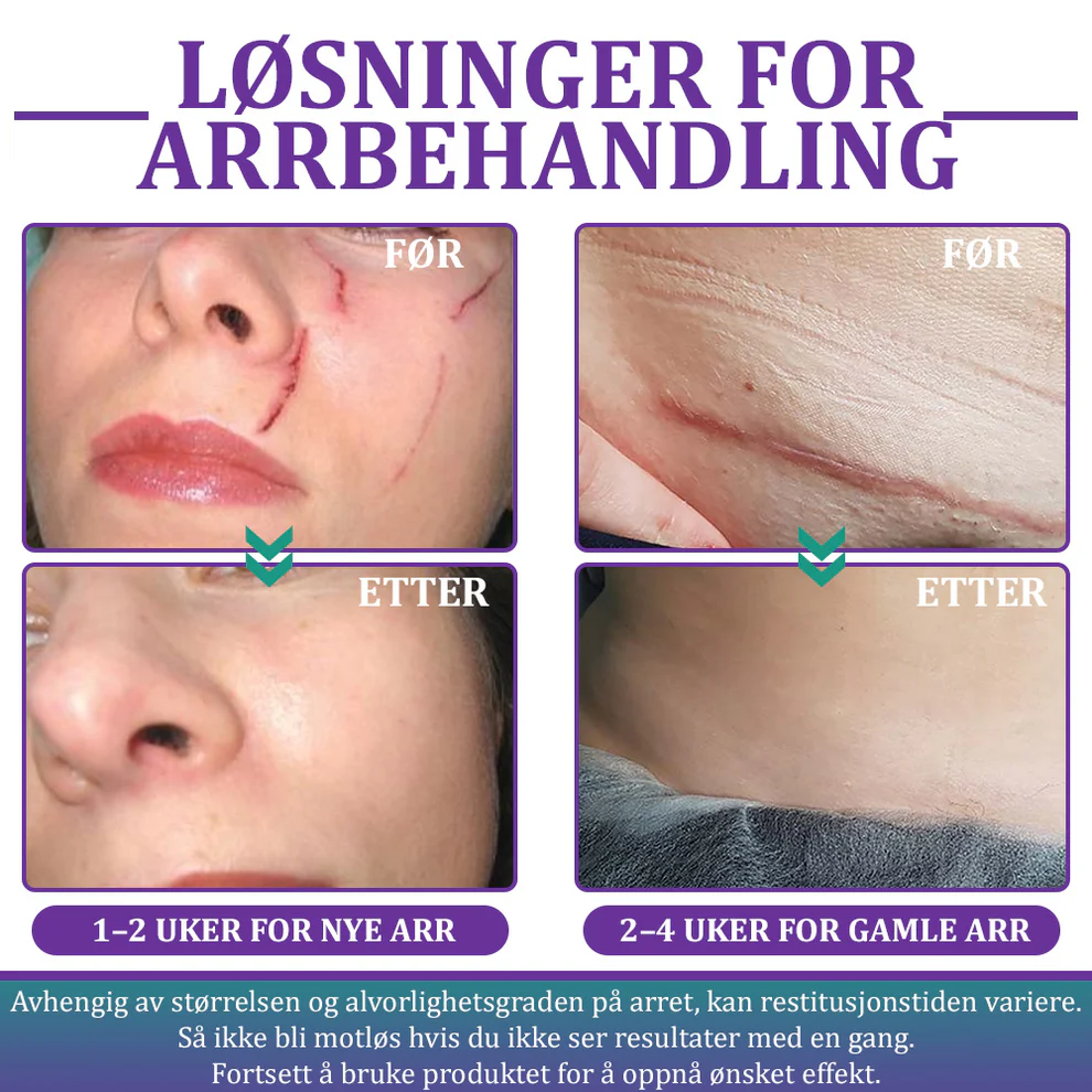 Flysmus® ReGen Hyaluronic Acid Nano-Heal Microneedle Tape 9 Flysmus® ReGen Hyaluronic Acid Nano-Heal Microneedle Tape