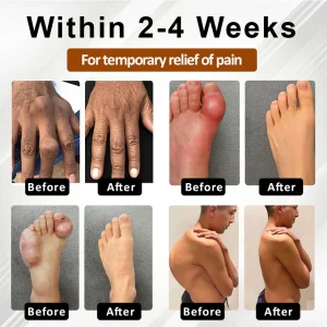 NovaRX® MagniBee Joint Support Formula Spray