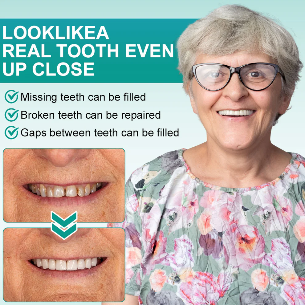 Ourlyard® Instant Stick on Dental Veneers 6 Ourlyard® Instant Stick on Dental Veneers