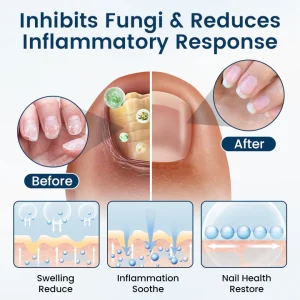 Ourlyard® NailGuard Fungal Repair Herbal Spray 9 Ourlyard® NailGuard Fungal Repair Herbal Spray