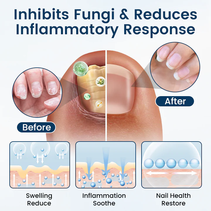 Timilk® OnyxiGuard Fungal Repair Herbal Spray 7 Timilk® OnyxiGuard Fungal Repair Herbal Spray