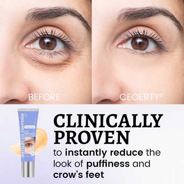 Ceoerty® InstaLift Eye Tightener 2 Ceoerty® InstaLift Eye Tightener