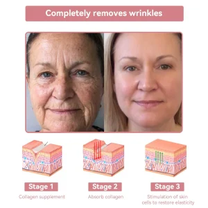 Awzlove™ Coenzyme Q10 Collagen Jelly Skin Cream 21 Awzlove™ Coenzyme Q10 Collagen Jelly Skin Cream