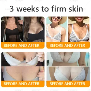 Daasry® Bee Venom Treatment Cream 22 Daasry® Bee Venom Treatment Cream