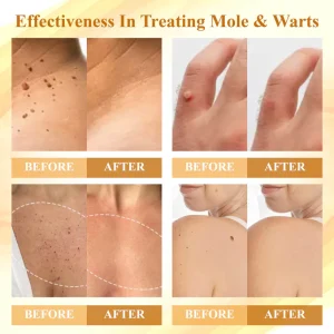 Fivfivgo® Condense Mellifera Venom Skin Repairing Cream 8 Fivfivgo® Condense Mellifera Venom Skin Repairing Cream