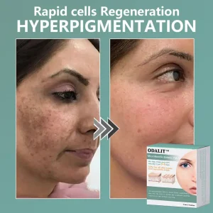 ODALIT™ MicroNeedle Botanic skin Tag Removal Patch