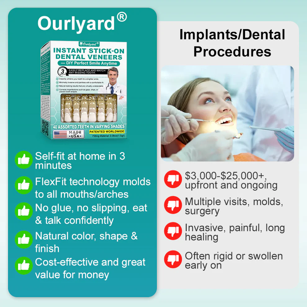 Ourlyard® Instant Stick on Dental Veneers 4 Ourlyard® Instant Stick on Dental Veneers