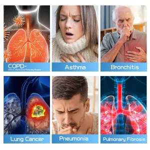 Ourlyard® DoubleNano Advanced Lung Detox Relief Patch 13 Ourlyard® DoubleNano Advanced Lung Detox Relief Patch