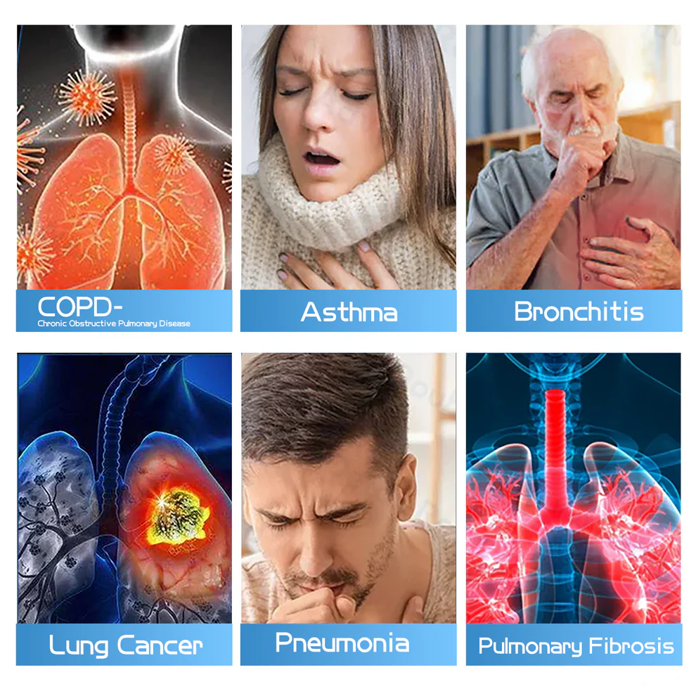 Ourlyard® DoubleNano Advanced Lung Detox Relief Patch 6 Ourlyard® DoubleNano Advanced Lung Detox Relief Patch