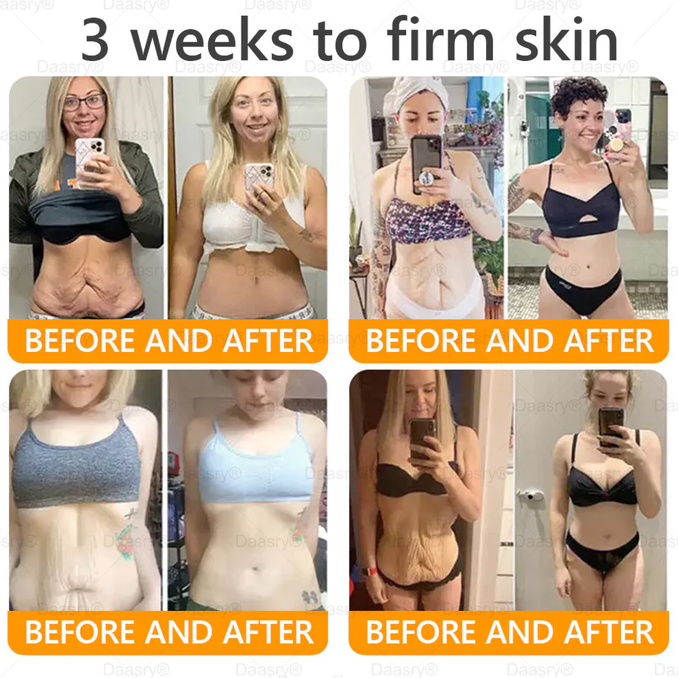 Daasry® Bee Venom Treatment Cream 10 Daasry® Bee Venom Treatment Cream