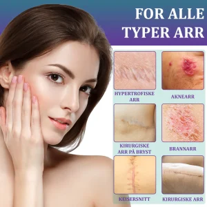 Flysmus® ReGen Hyaluronic Acid Nano-Heal Microneedle Tape 15 Flysmus® ReGen Hyaluronic Acid Nano-Heal Microneedle Tape