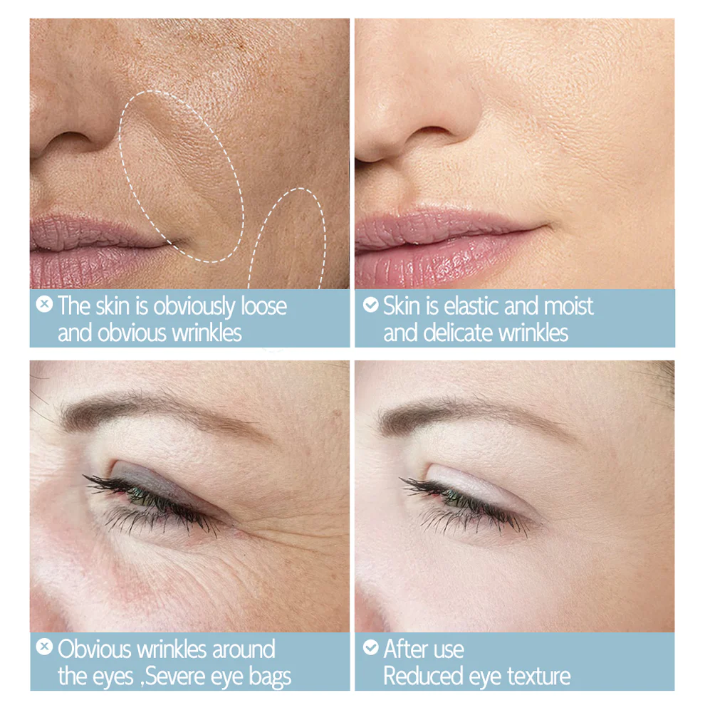 Neslemy™ Anti-Wrinkle Firming Cream 3 Neslemy™ Anti-Wrinkle Firming Cream