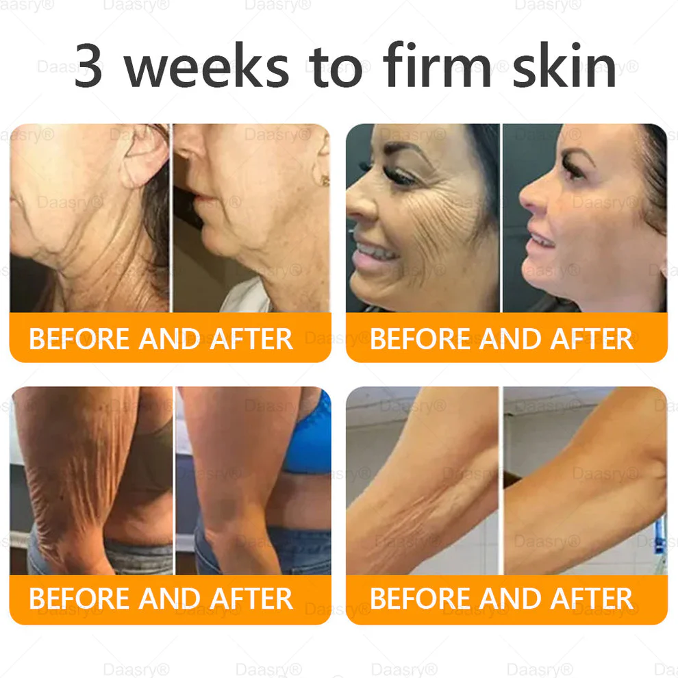 Daasry® Bee Venom Treatment Cream 9 Daasry® Bee Venom Treatment Cream