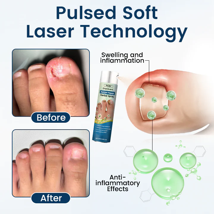 Timilk® OnyxiGuard Fungal Repair Herbal Spray 5 Timilk® OnyxiGuard Fungal Repair Herbal Spray