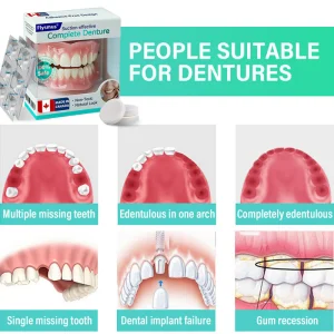 Flysmus® Suction-fit Complete Denture 9 Flysmus® Suction-fit Complete Denture