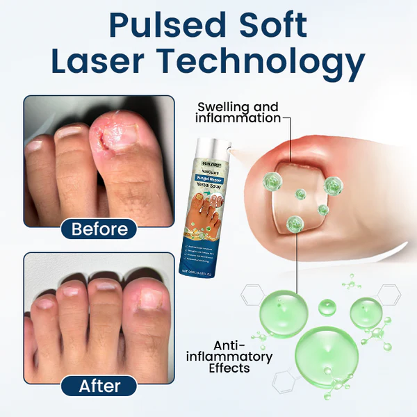 Ourlyard® NailGuard Fungal Repair Herbal Spray 3 Ourlyard® NailGuard Fungal Repair Herbal Spray