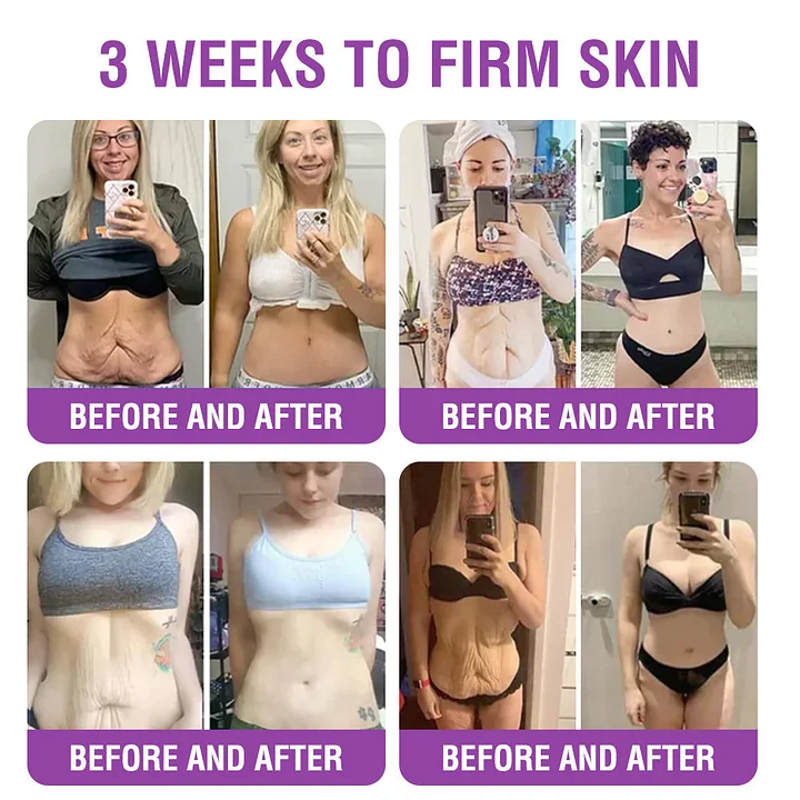 YUNPSO™ Queen Nectar Peptide + Bakuchiol Skin Restoration Cream 8 YUNPSO™ Queen Nectar Peptide + Bakuchiol Skin Restoration Cream