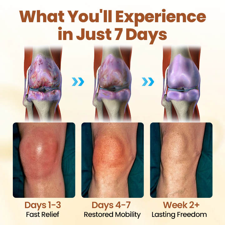 Caselast® Premium Curcumin Pain Relief Gel 6 Caselast® Premium Curcumin Pain Relief Gel