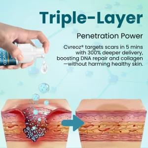 Cvreoz® Advanced Scar Gel 11 Cvreoz® Advanced Scar Gel