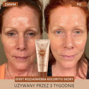 Parowu™ Whitening and Brightening Mask 10 Parowu™ Whitening and Brightening Mask