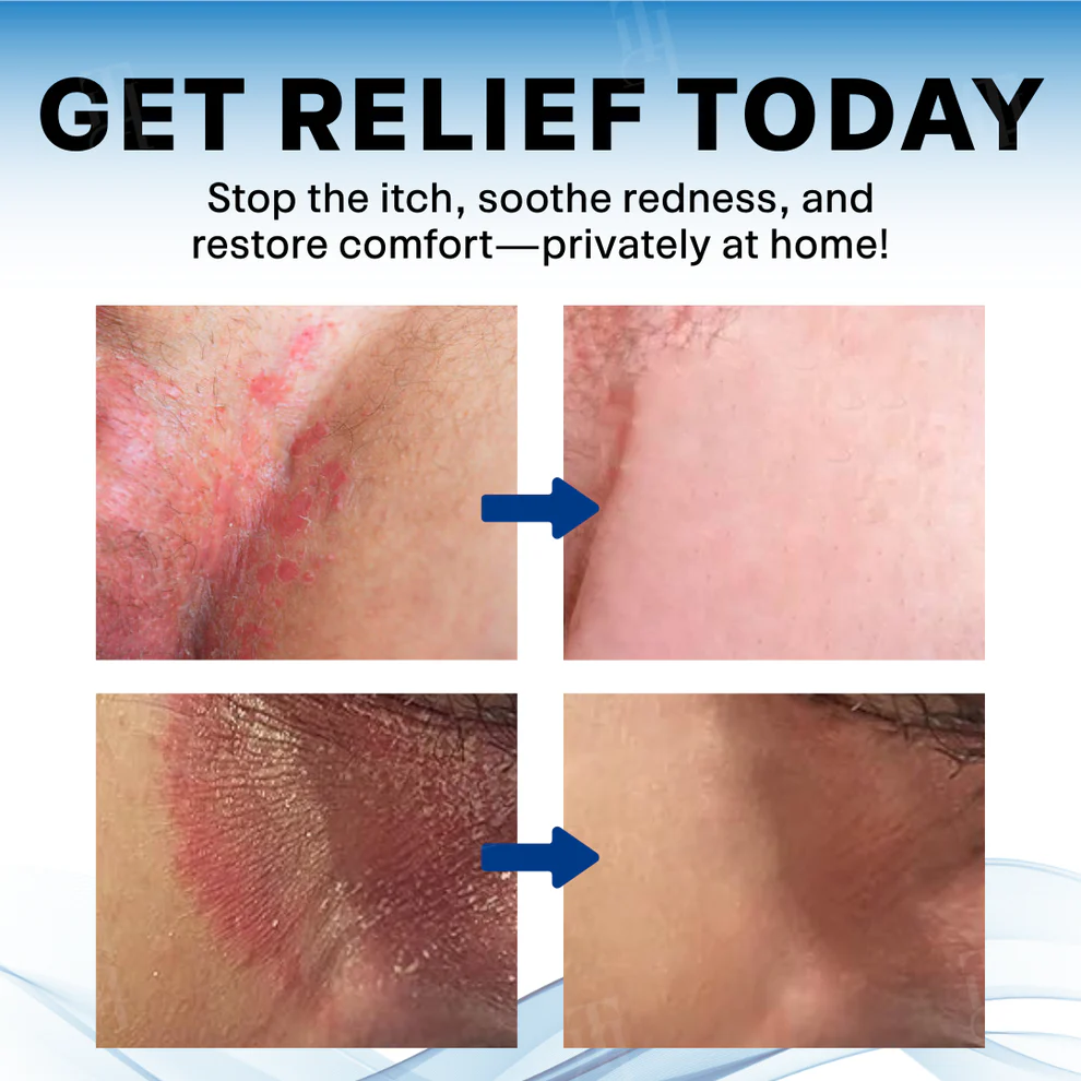 Croaie® Scrotum Itchy Treatment Cream 7 Croaie® Scrotum Itchy Treatment Cream