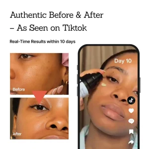 NESLEMY™Retinal Skin Booster Serum 17 NESLEMY™Retinal Skin Booster Serum